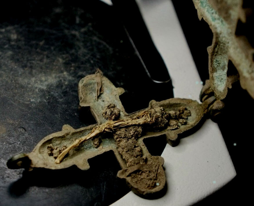 Фото из интернета, он не фотографировал процесс вскрытия. Источник: https://yandex.ru/images