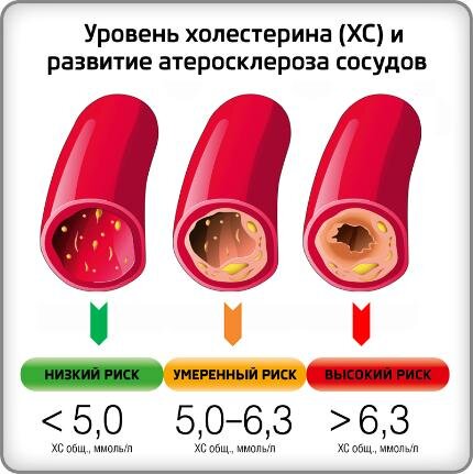 На данном фото показана связь уровня холестерина и риском развития атеросклероза сосудов.