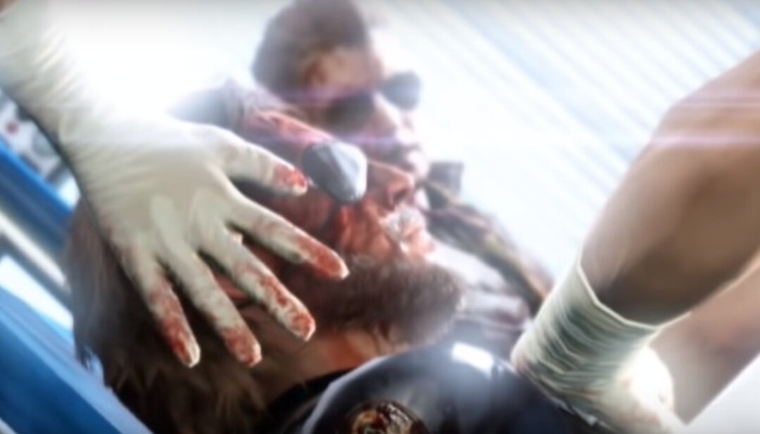 Биг Босс оказывается в коме на 9 лет