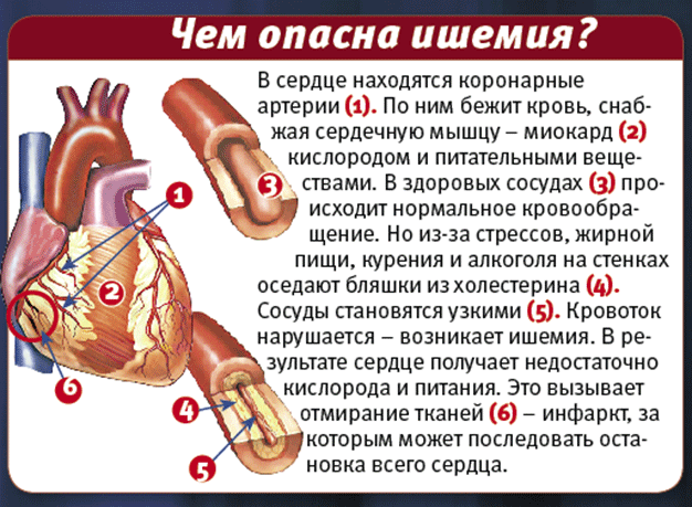 -3