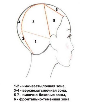 Все участки (кроме нижнезатылочной) фиксируются зажимами или резинками.