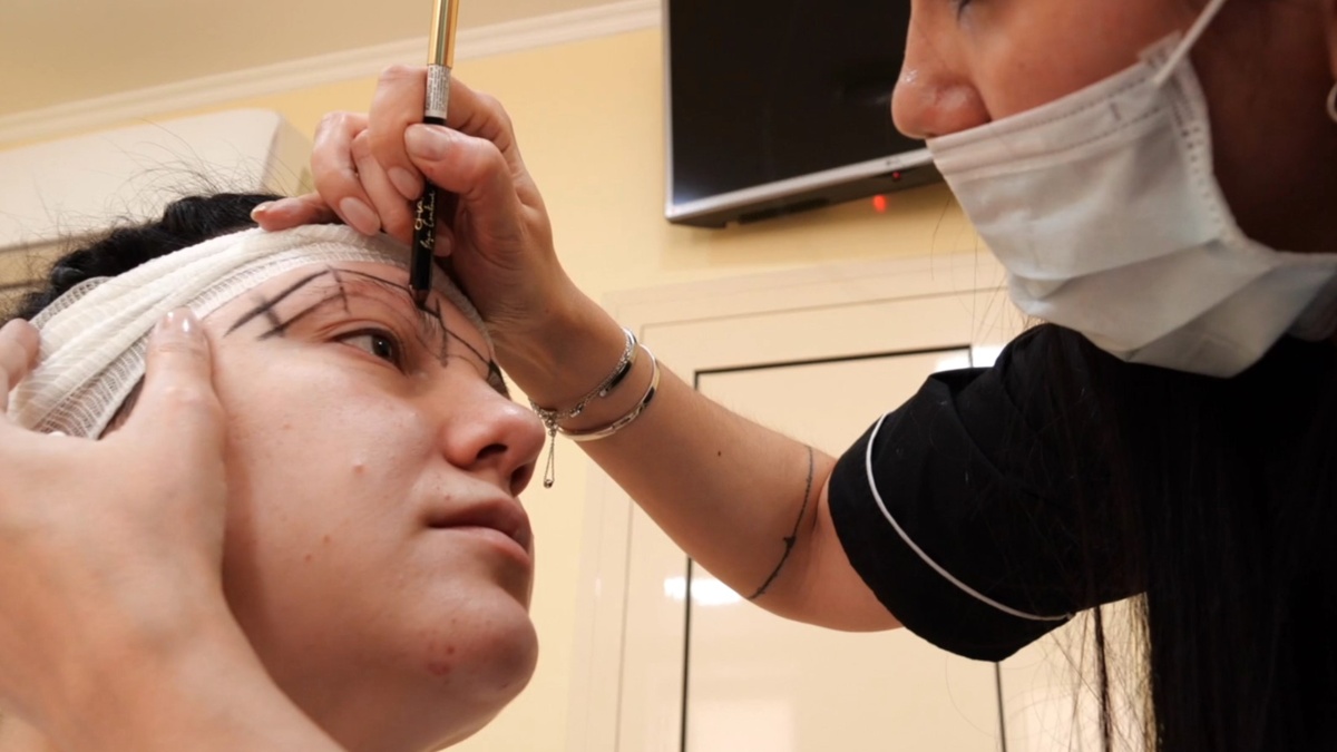 Услуги по пересадке бровей