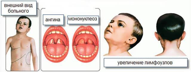 Причины и пути передачи инфекции