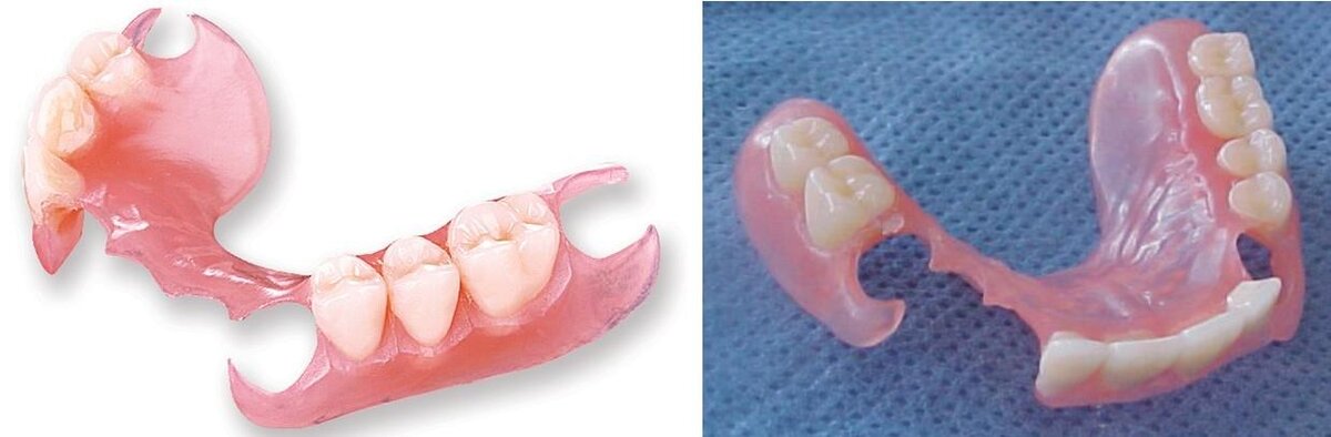 Частичные съемные протезы картинки