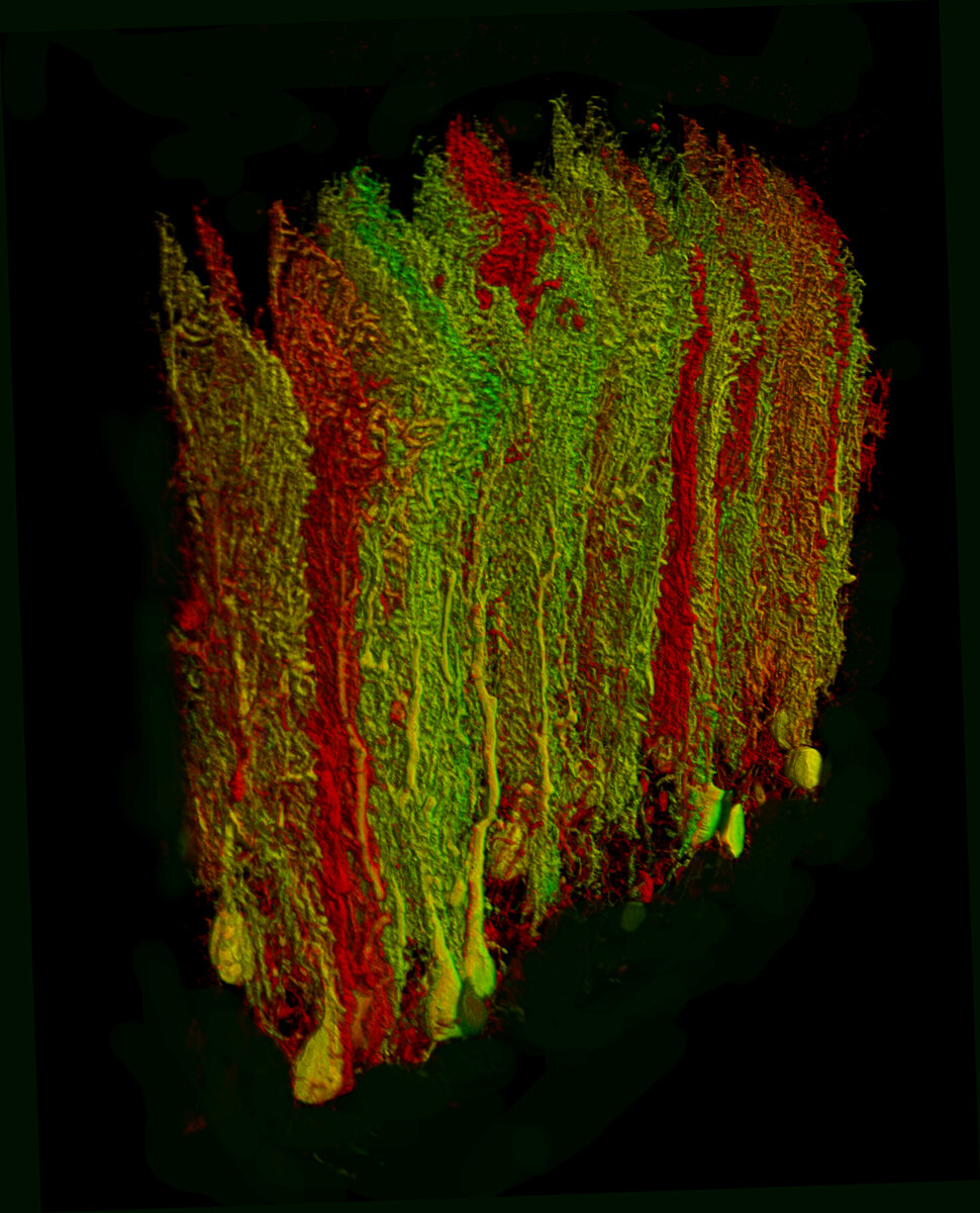 Картинка дня: клетки Пуркинье в 3D | Нейроновости | Дзен