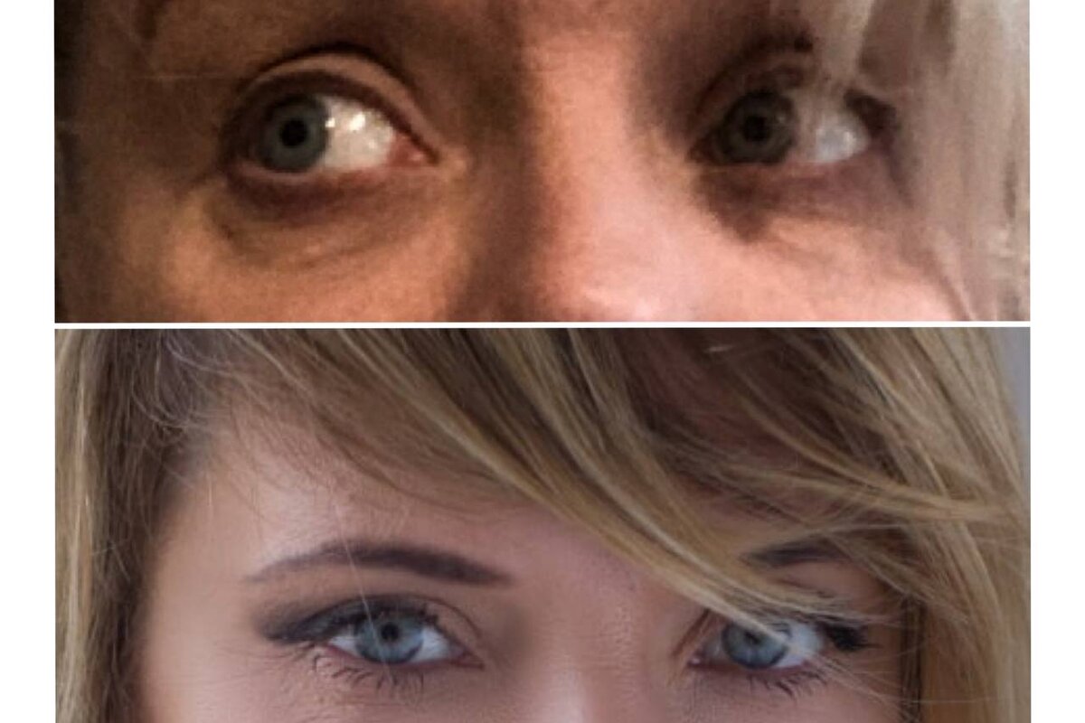 Мои глаза с разницей в 2 месяца