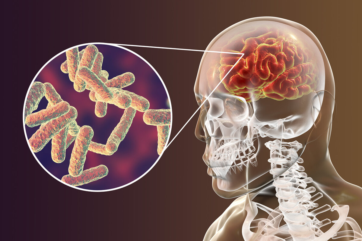 Рис.: clinicalconnection.hopkinsmedicine.org