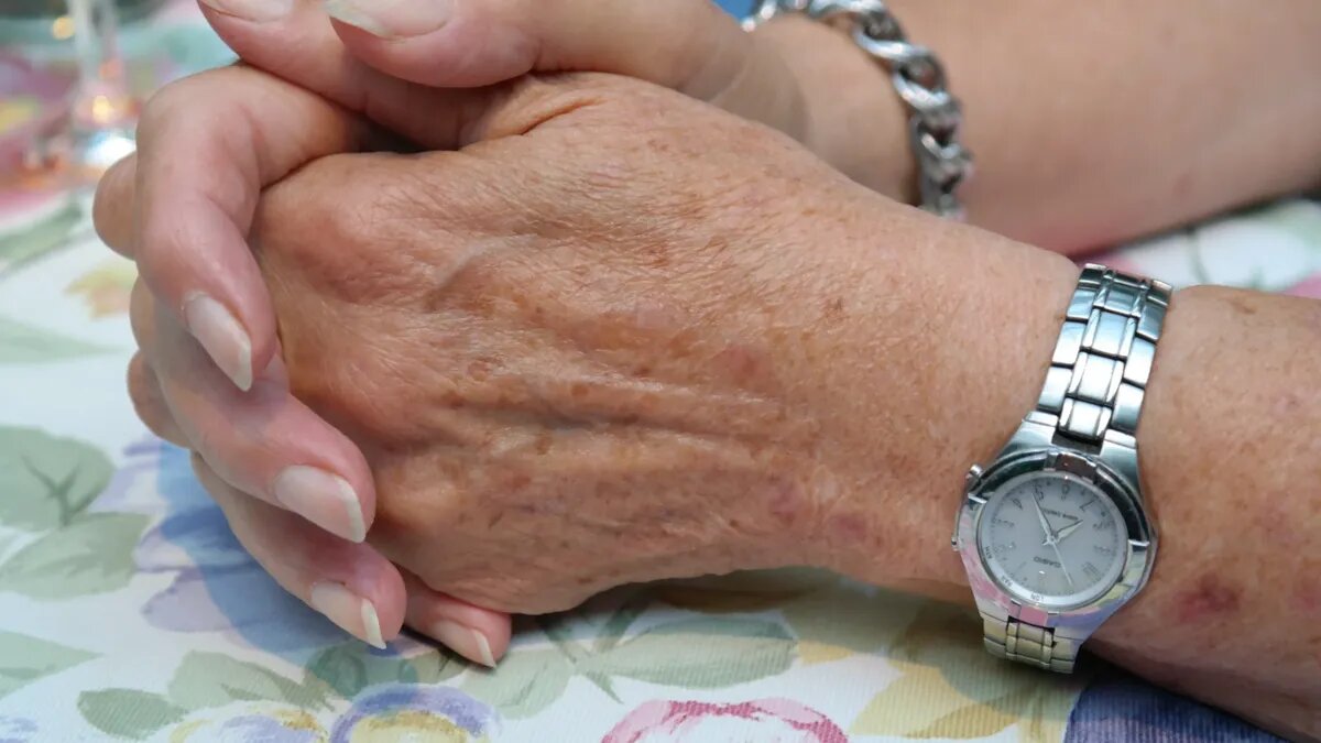 Лечение лучше всего начинать с консультации у врача-дерматолога. Фото: pxhere.com