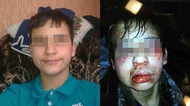 Пострадавший инвалид Костя (до и после избиения). Фото: соцсети