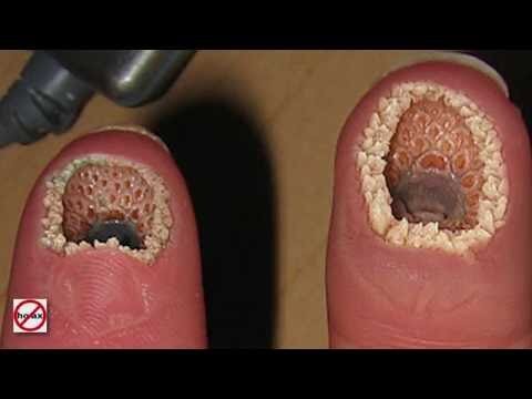 Семена лотоса 