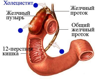 Классификация