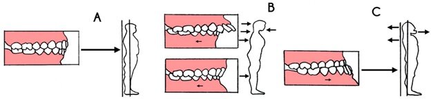 
Схема зависимости постуры и окклюзии