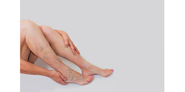 Источник: https://med.vesti.ru