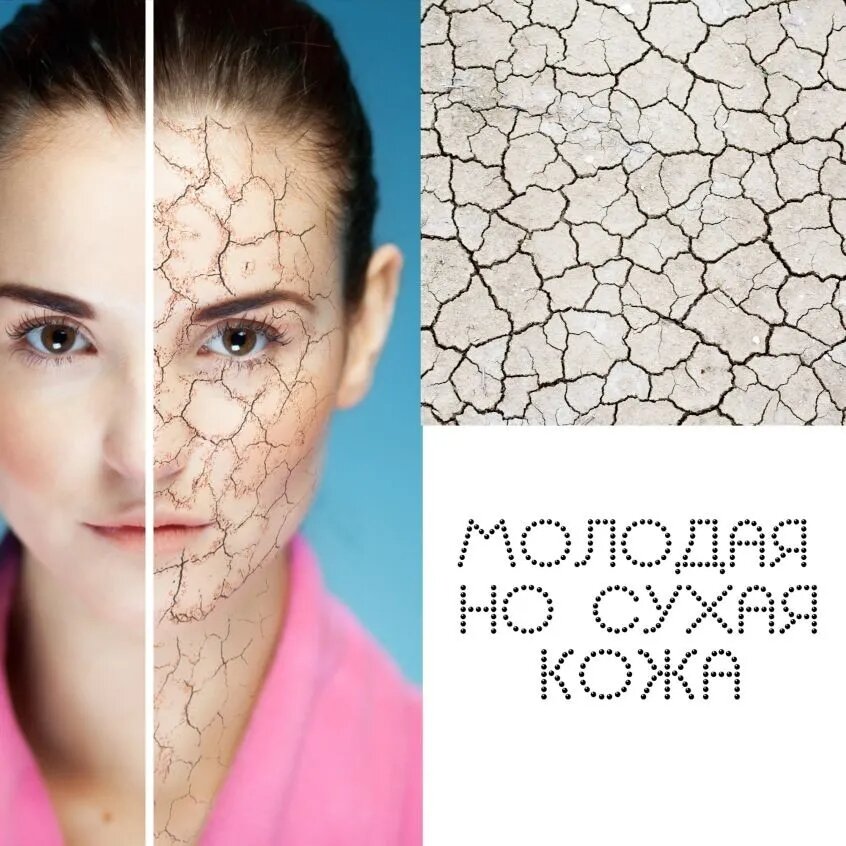 Плюсы и минусы сухой кожи в молодости | Digital Beauty | Дзен