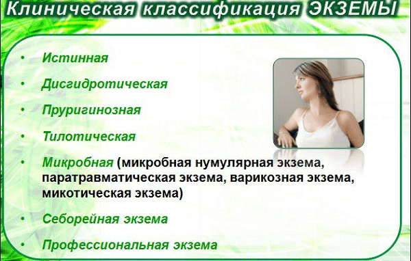 Основные виды экземы