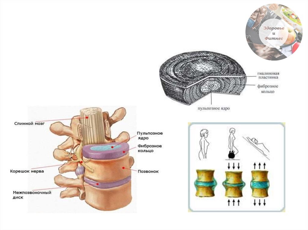 Межпозвоночный диск. Из чего состоит Позвоночный диск. Фиброзное кольцо межпозвоночного диска. Межпозвоночный диск строение и функции. Межпозвоночный диск строение диск.