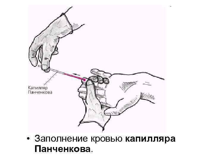 Фото с сайта https://unimed.ru/biblioteka/gematologiya1/skorost-osedaniya-ehritrocitov-sovremennye-metody-opredeleniya-i-klinicheskaya-interpretaciya.html