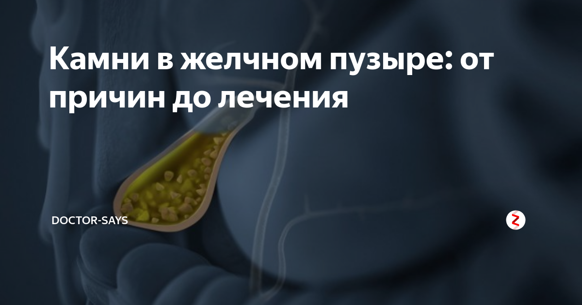 Как быстро снять воспаление желчного Symptoms of gallbladder inflammation Royalty Free Vector