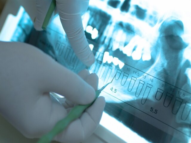 5 тенденций, меняющих современную стоматологию