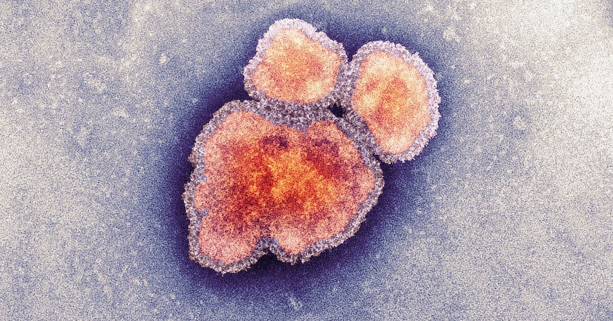 Поколение людей, которым сейчас около 30 лет крайне легкомысленно относится к кори, и вот почему. В начале девяностых несмотря на проблемы в здравоохранении в целом, за вакцинацией все же строго следили. Непривитых детей не принимали в детские учебные учреждения и соответственно даже те, кто не хотел вакцинировать детей, был вынужден это делать. Иммунная прослойка общества была довольно высокой, и вспышки кори регистрировались очень редко. Но прошло время, вакцинация стала добровольной, и теперь мы пожинаем «плоды» антипрививочного течения.