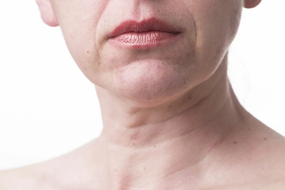 Источник: https://healthmacho.com/loose-skin-tightening-8-home-remedies-for-loose-skin/