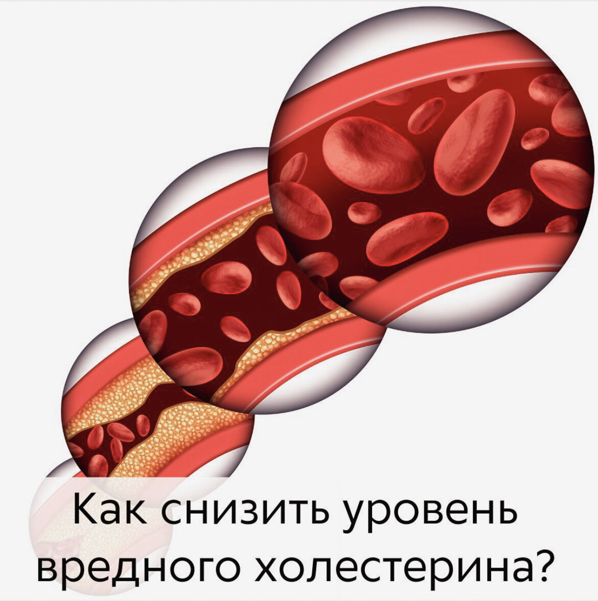 Какие продукты снижают холестерин?