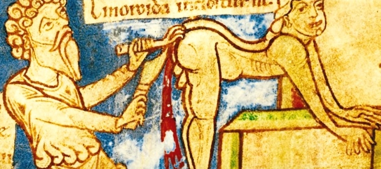 пример лечения геморроя в древности