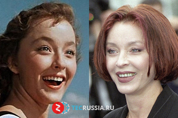 Фото вертинской анастасии до и после пластики