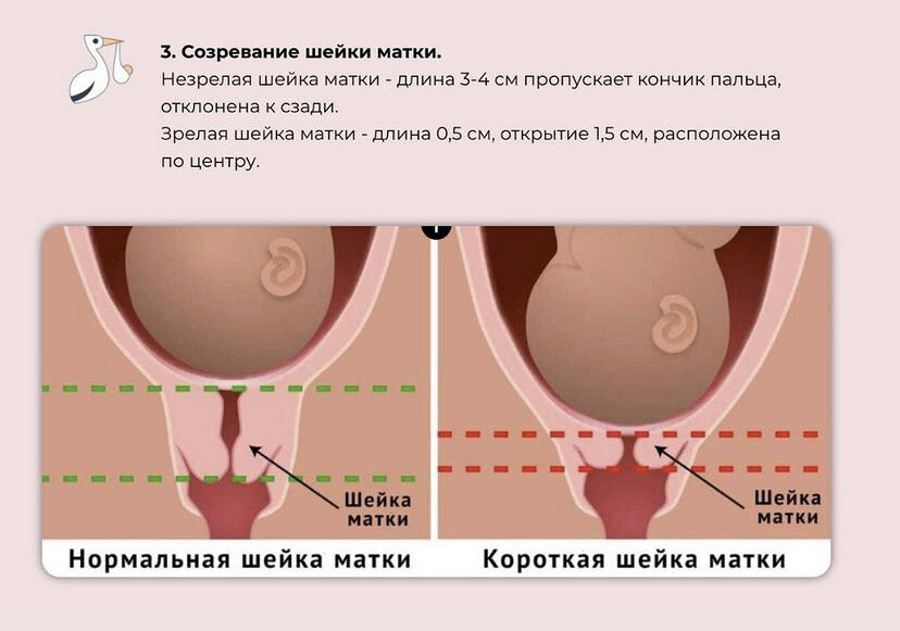 Маленькие секреты: половое развитие девочки - ISIDA