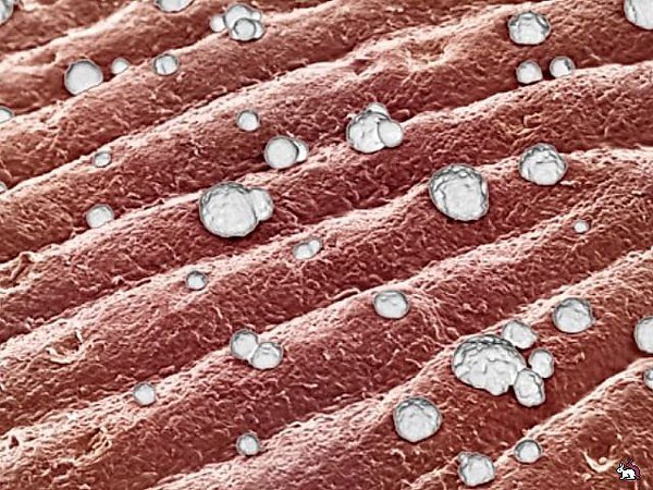 так выглядят папилярные линии под микроскопом