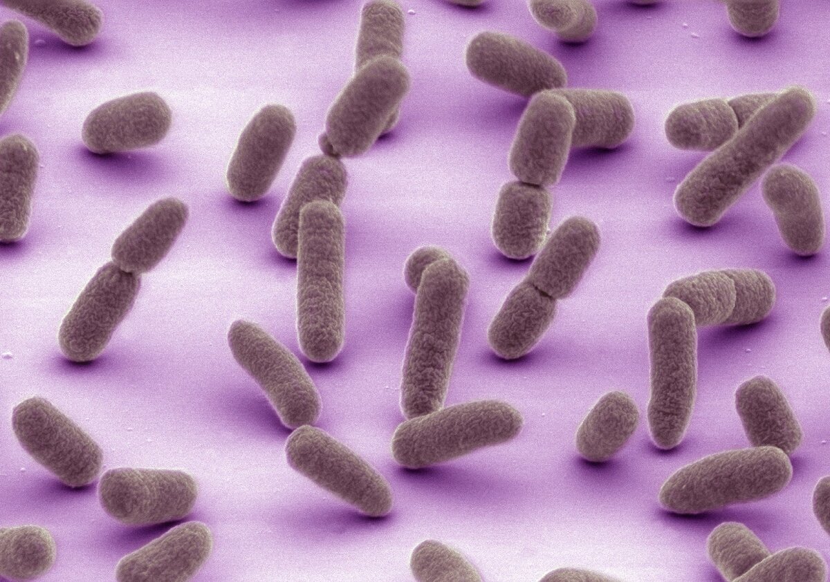 Бактерия Escherichia coli. Кишечная палочка Escherichia coli. О микроорганизмы Escherichia coli. Эшерихия кишечная палочка.