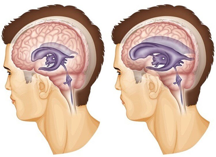 Источник фото: neosensys.com