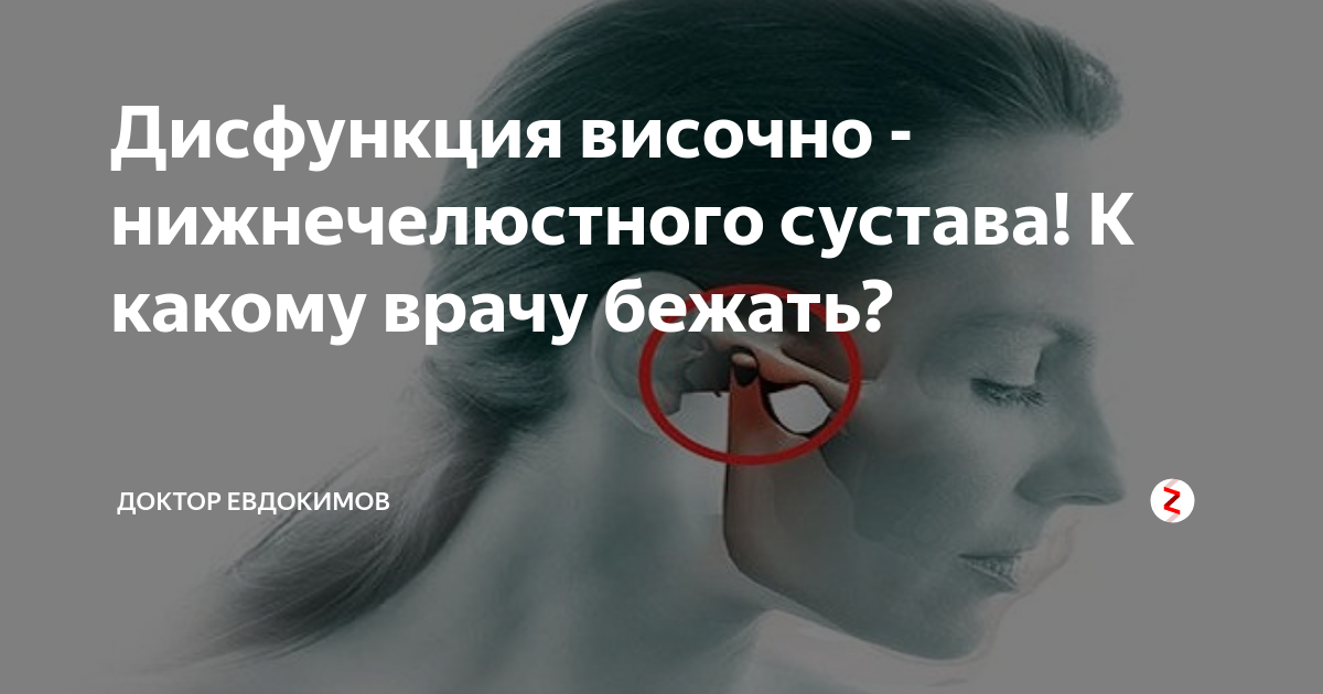 Дисфункции суставов. Дисфункция височно-нижнечелюстного сустава. Дисфункция челюстного сустава. Мышечно суставная дисфункция ВНЧС. Дисфункция височно-нижнечелюстного сустава упражнения.