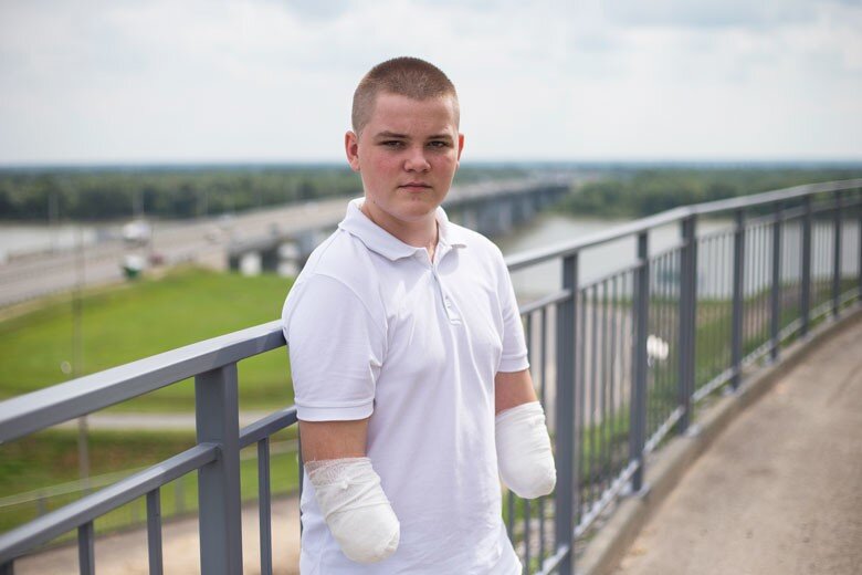 Ярослав после трагедии. Фото: ok.ru