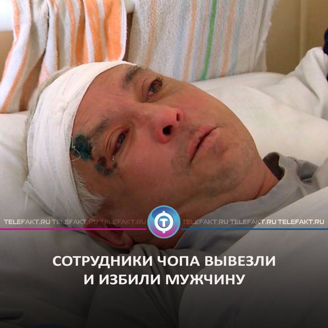 Эдуард Ахметшин сейчас лежит в больнице с множественными травмами: кровоизлияние в мозг, переломы челюстно-лицевых костей, химические ожоги глаз и легких.