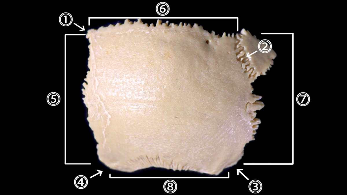  Теменная кость, вид снаружи