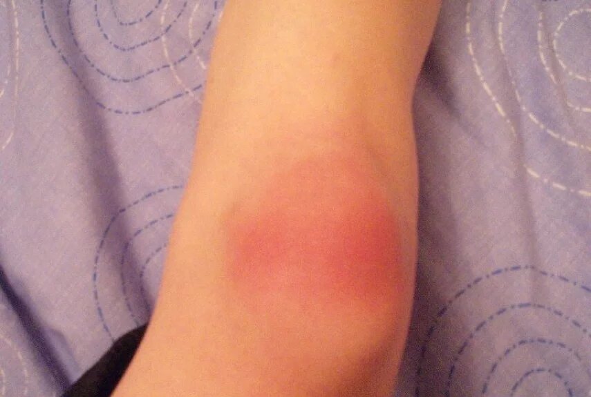 Фото: flickr.com