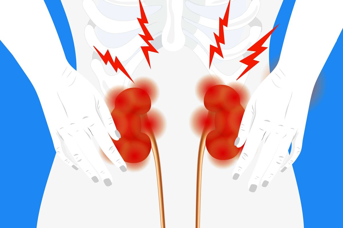 Где находится почки у человека фото и как болит какие симптомы