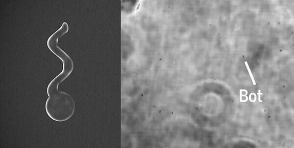 Микро-боты в глазе под микроскопом