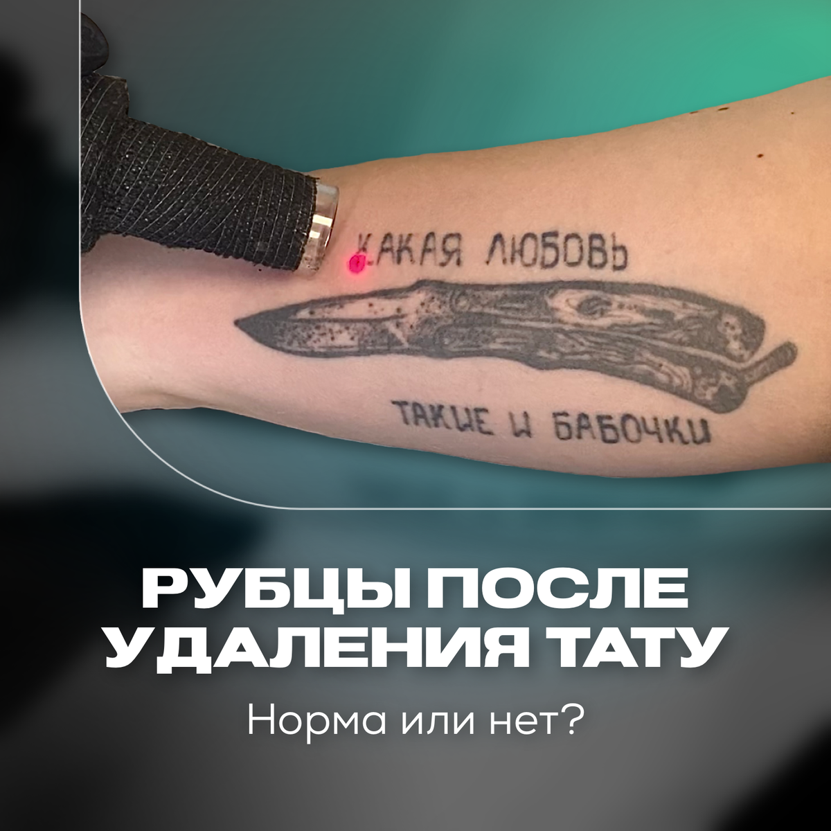 Tattoo Off - Россия | Официальный сайт представительства