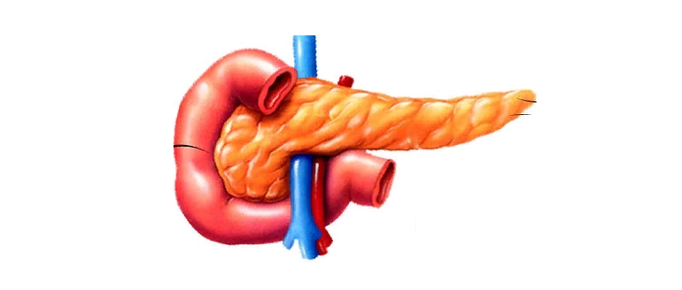 Что убивает поджелудочную железу? - Полезная информация от клиники «КИТ»