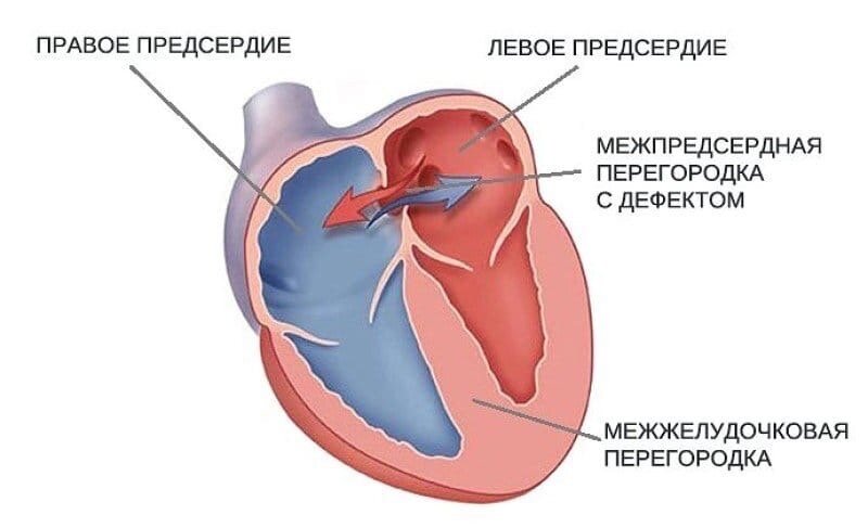 9 безопасных состояний младенца, которые могут напугать родителей