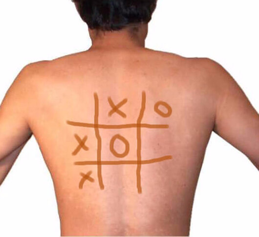 фото по запросу йодная сетка яндекс картинки