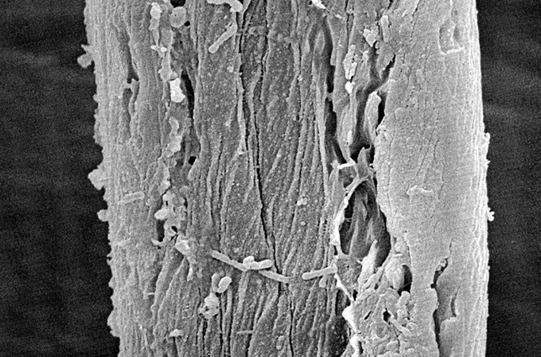 Волос под. Поврежденный волос под микроскопом Кортекс. Кортекс волоса под микроскопом. Волос под микроскопом. Срез волоса под микроскопом.