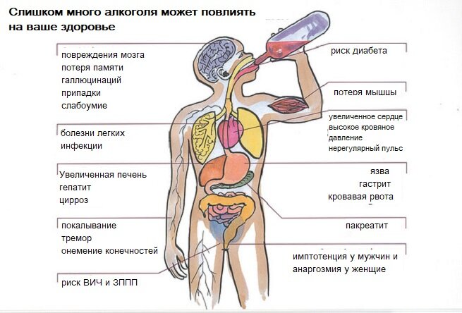 Белая горячка (алкогольный психоз или делирий) проявляется преимущественно в трезвом состоянии, никогда человек в алкогольном опьянении не будет чувствовать признаки болезни.