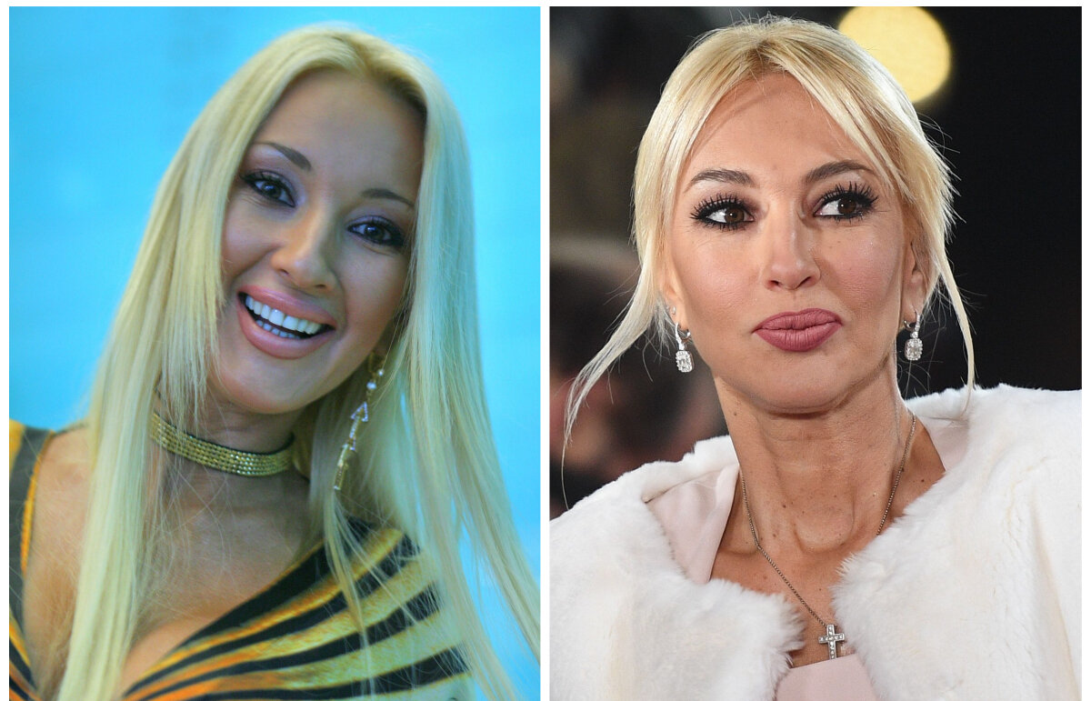 Лера Кудрявцева до и после пластики