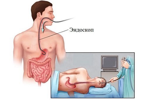 Где находится и как болит двенадцатиперстная кишка?