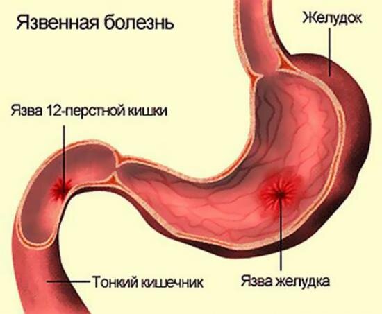 Горечь во рту