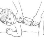 Не знаете как ставить горчичники при бронхите читаем подробную статью.