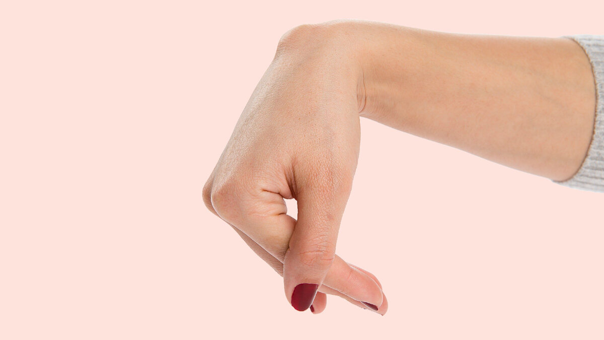 Гигрома тыльной поверхности запястья/лучезапястного сустава. Фото из открытых источников. 